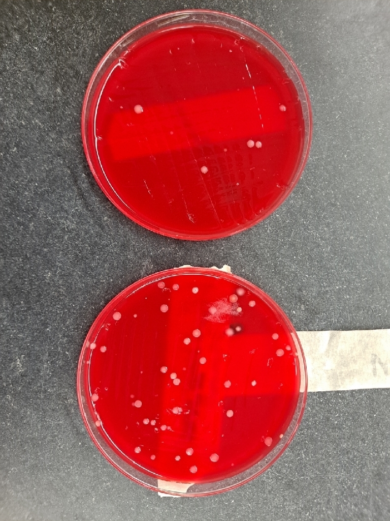 Dirty (bottom) vs clean (top) hands results