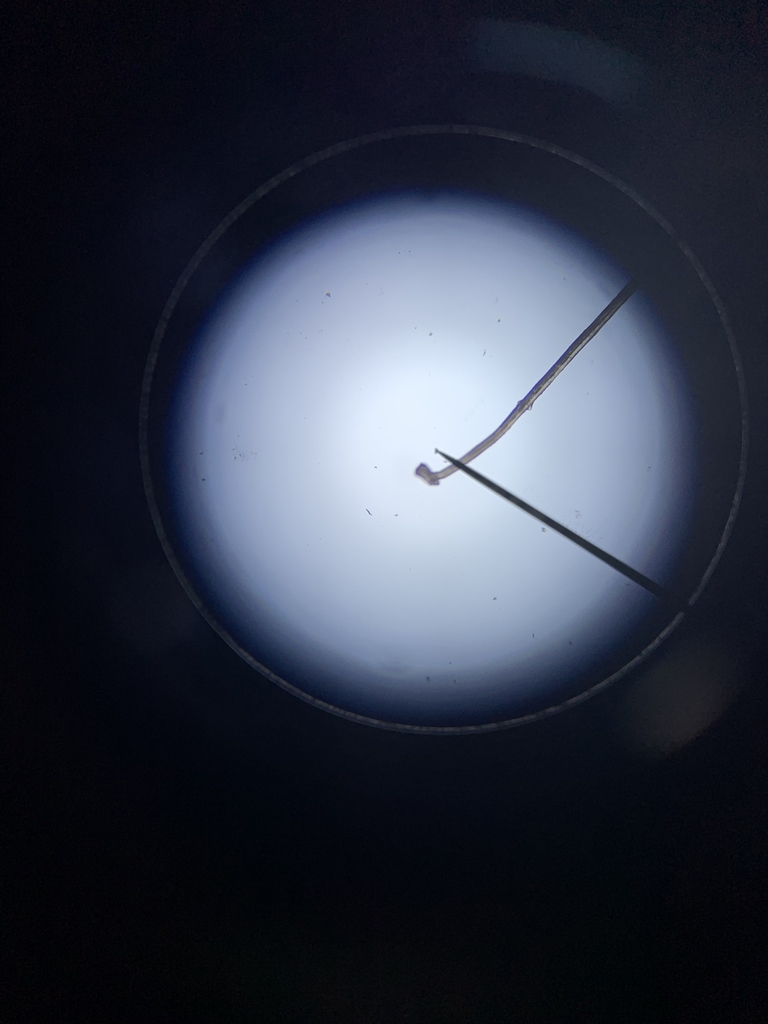 Hair under the microscope.